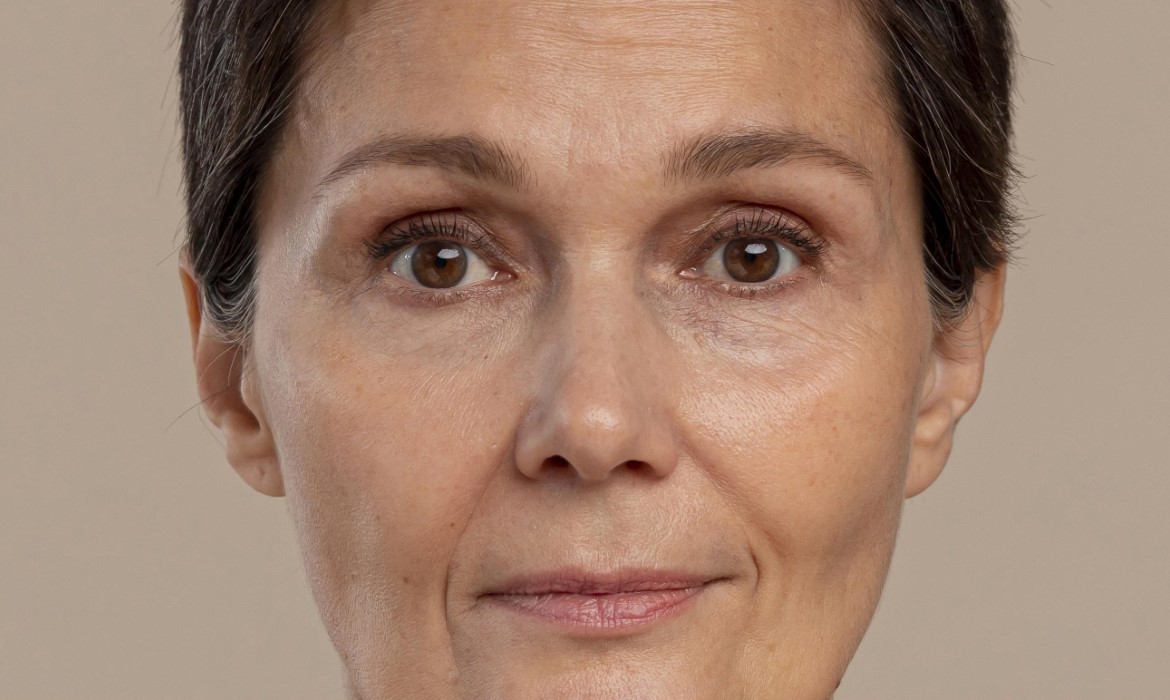 blepharoplasty before surgery