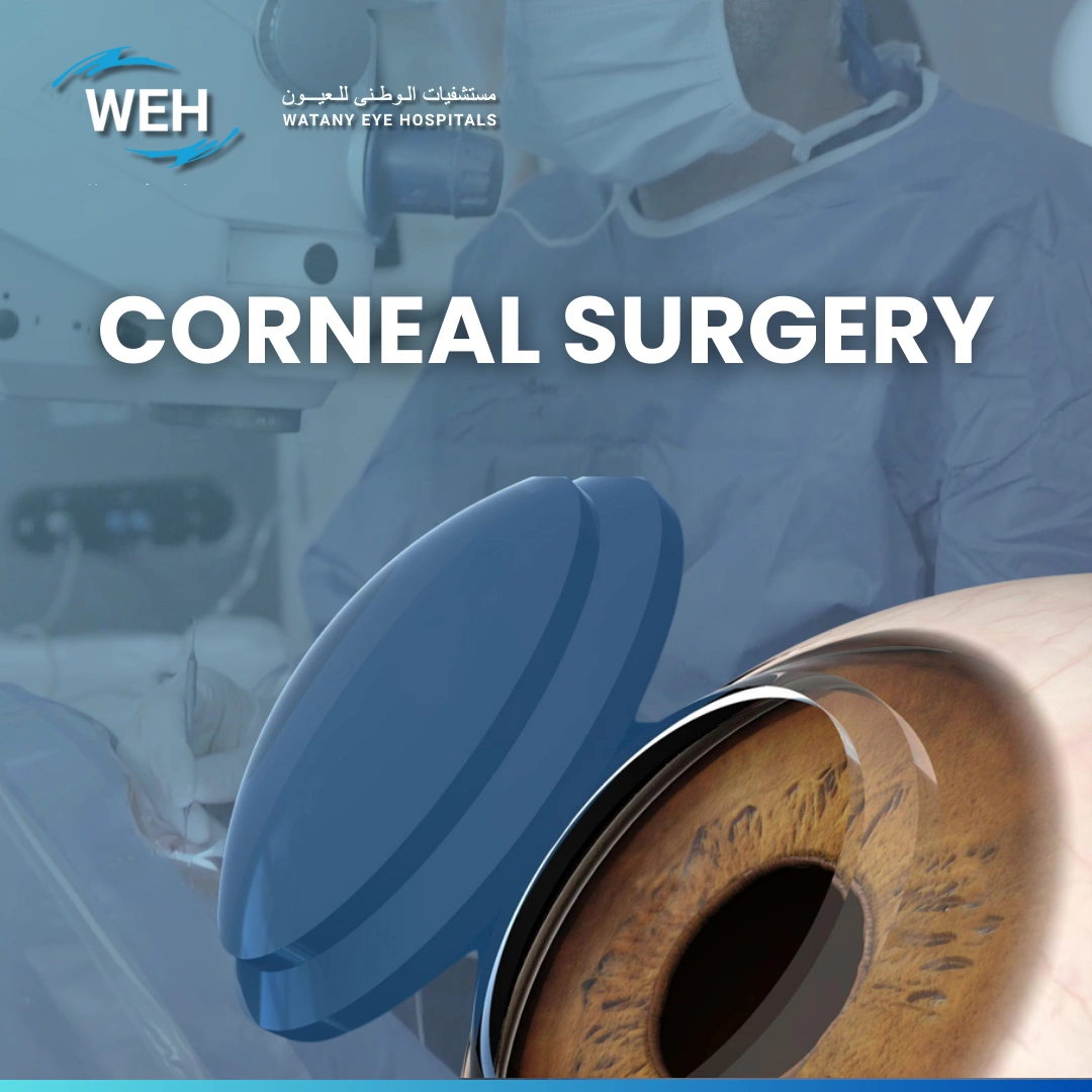 Corneal Surgery