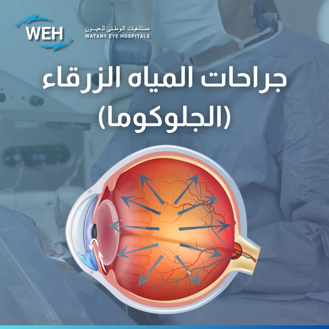 عملية المياة الزرقاء